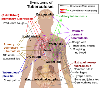 676px Tuberculosis symptoms.svg+(1)