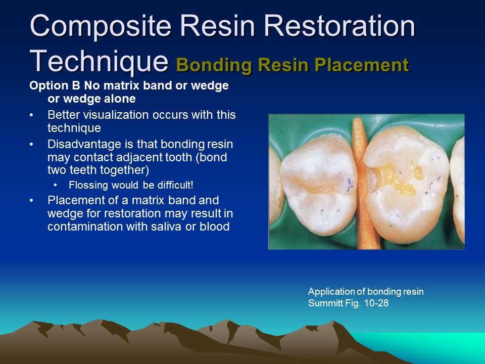 Dentistry Composite Resin
