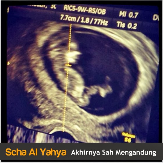 Scha Al Yahya Sah Mengandung