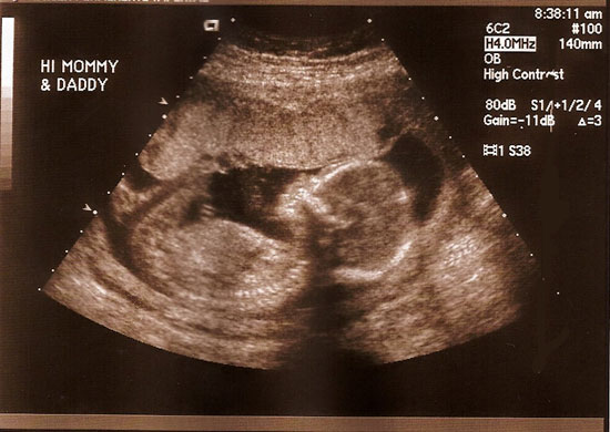 baby gender predictor boy or girl predictor simple ways to find