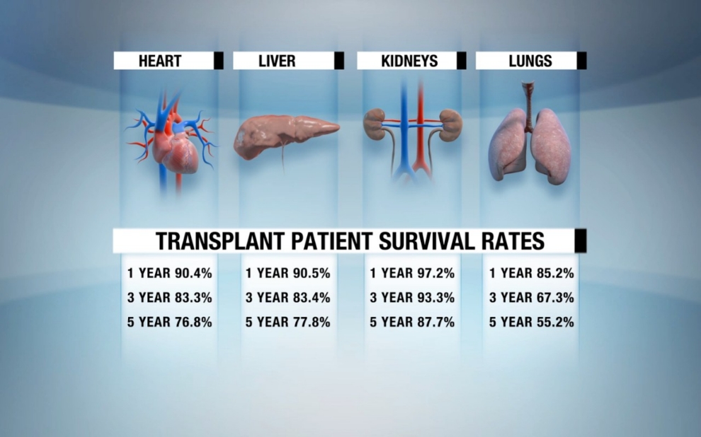 trendssoul by 246 zlem yan devrim organ transplant organ rejection