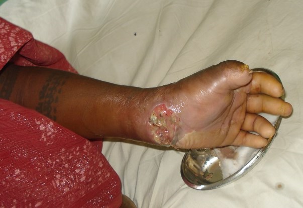 The Learner: Neglected Hand . . . Need Help