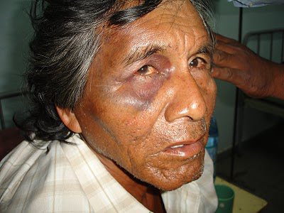 Ni 209 Os Con Hambre Nunca Mas Carta De Un Qom A La