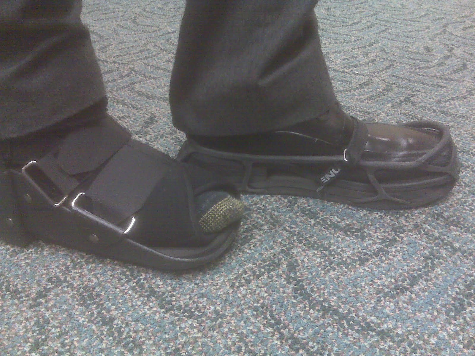 Foot and Ankle Problems By Dr. Richard Blake Calcaneal Foot and Ankle Problems By Dr. Richard Blake Calcaneal