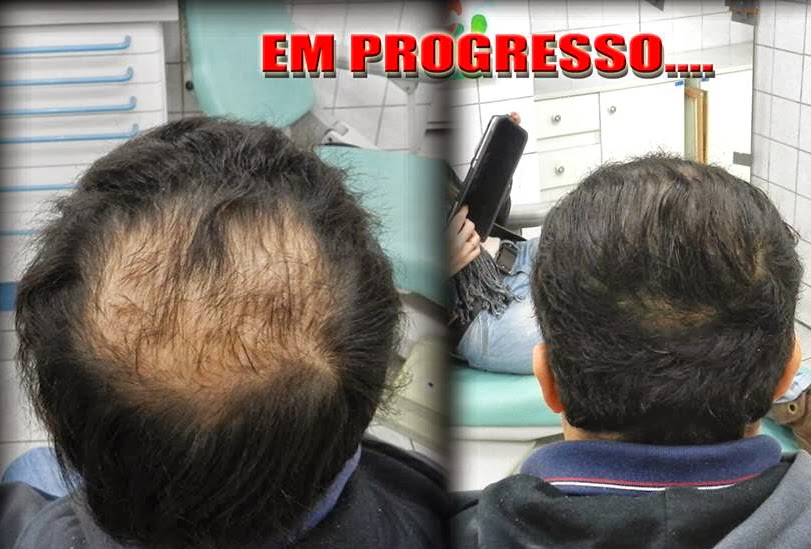 [Imagem: 1384887_552995838104490_88377404_n.jpg]