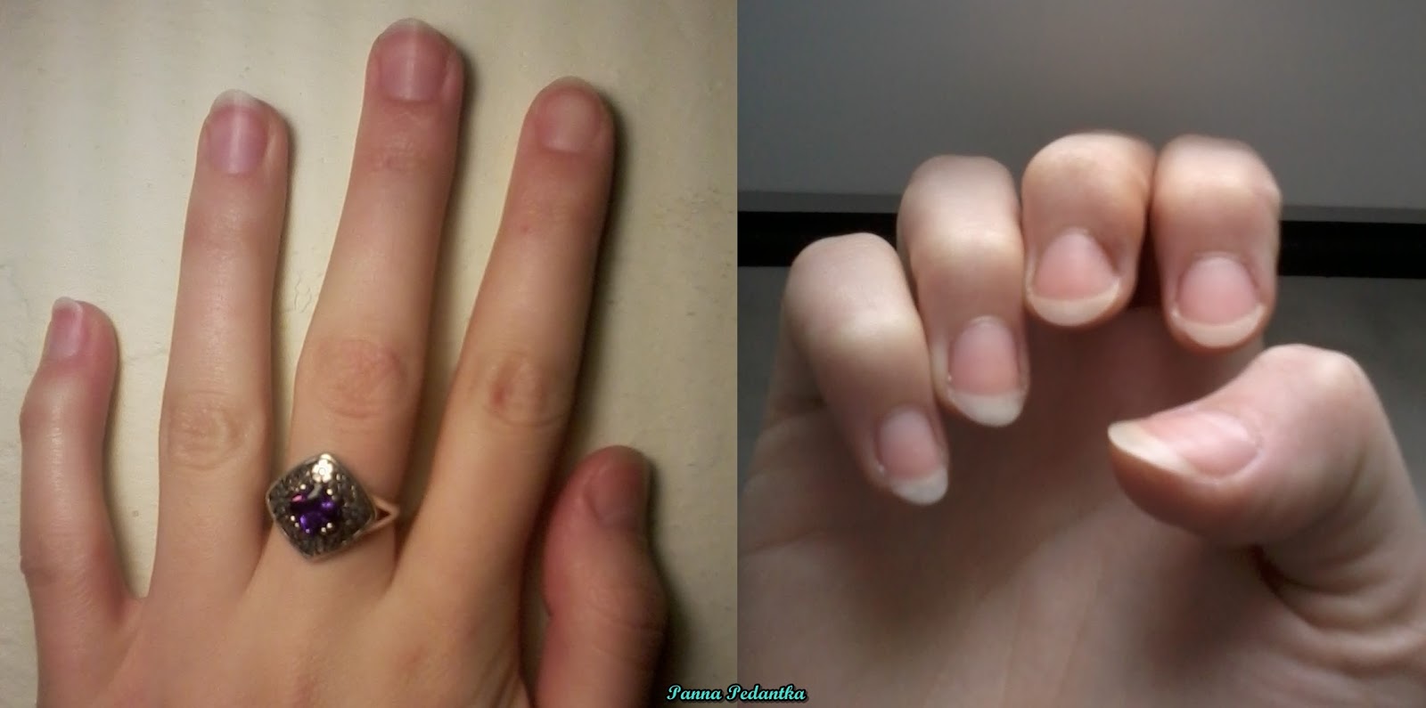 Olejek Rycynowy Na Wlosy I Paznokcie