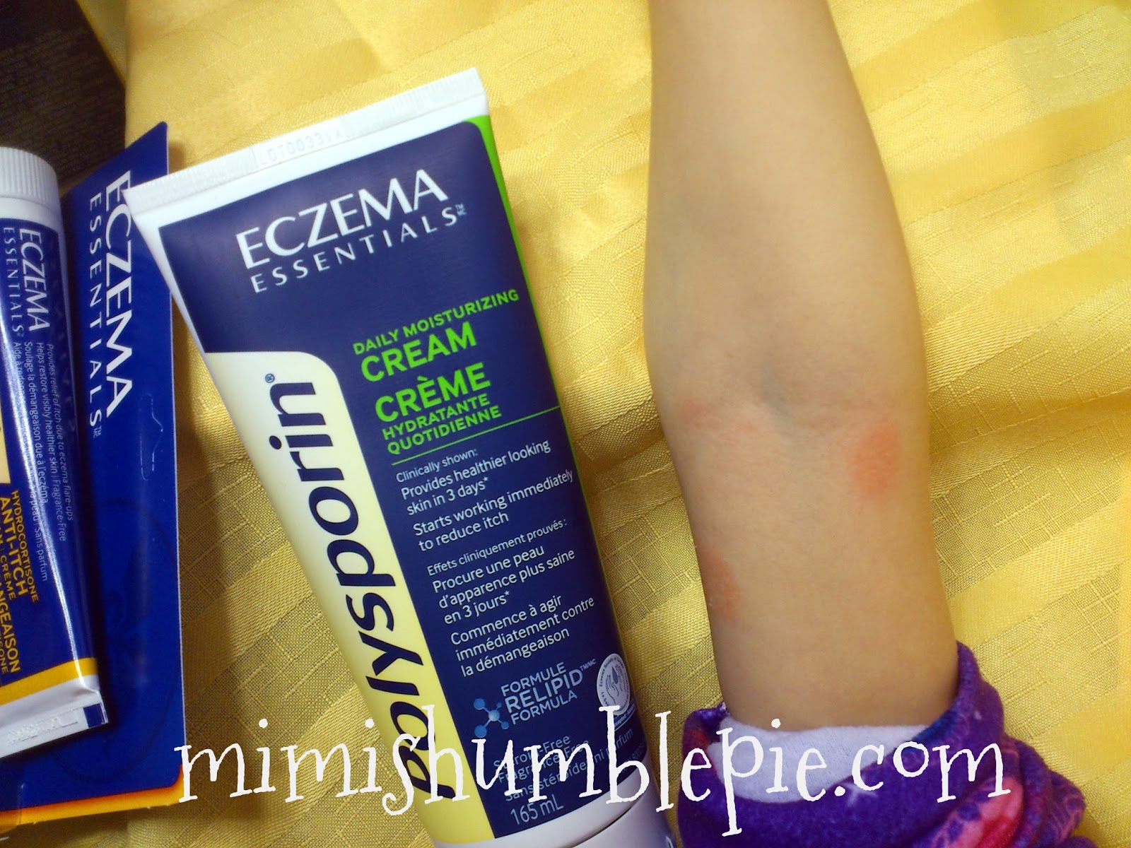 Battling Winter Eczema Flare ups with Polysporin Eczema Essentials 