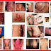 Obat ANTIBIOTIK SIPILIS Online thumbnail