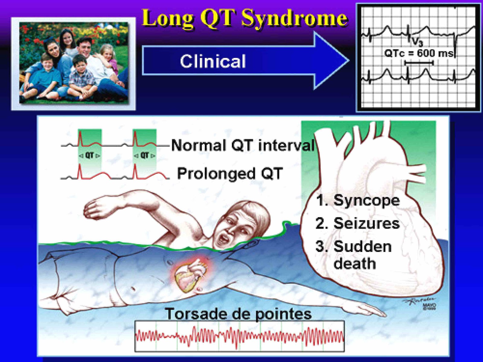 Azithromycin qt prolongation nejm career Azithromycin qt prolongation nejm career