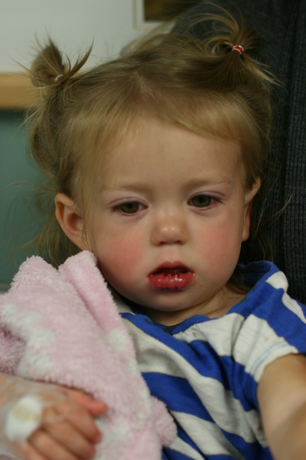 The Joneses 9 stitches