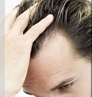 stop Hair Loss In Young Men