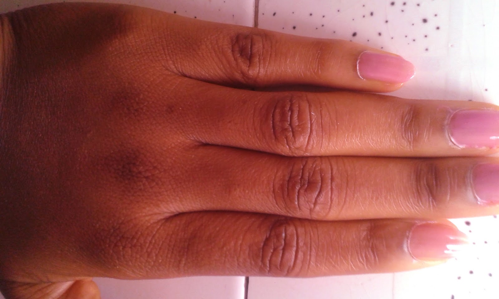 ebonytalknaija Get Out That Embarrasing Dark Knuckles Using This