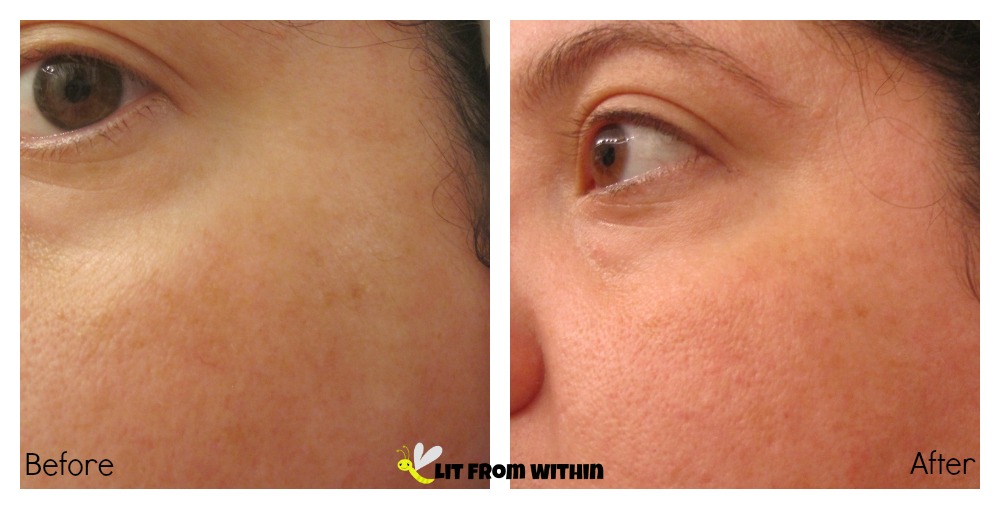 Lit from Within Lightening and Brightening with Key West Health