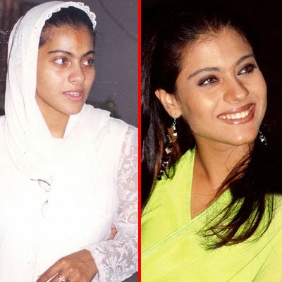 Almost all bollywood actresses and actor have undergone plastic surgery