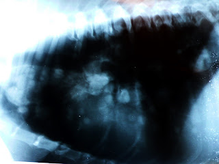 tumores pulmon