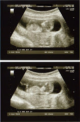 1st baby scan! Baby #4