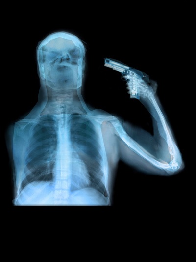 ahmed mater evolução homem raio-x posto gasolina