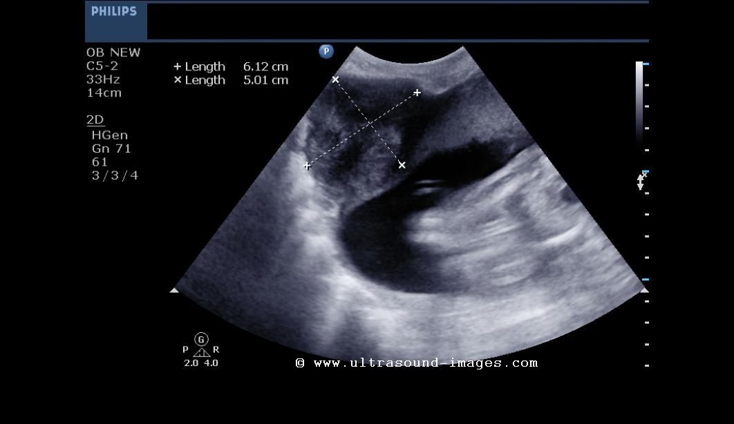 Natural Way To Check Pregnancy Natural Way To Check Pregnancy