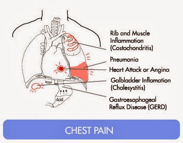 ICD 9 Code For Chest Pain