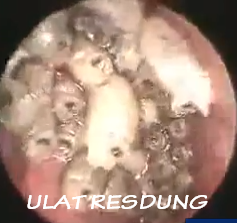 gambar ulat resdung - foto hewan - gambar ulat resdung