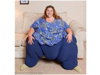 全球最肥女人 318公斤想減200公斤