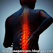 Gejala Osteoporosis (Pengeroposan Tulang) ~ Obatnya AgaricPro