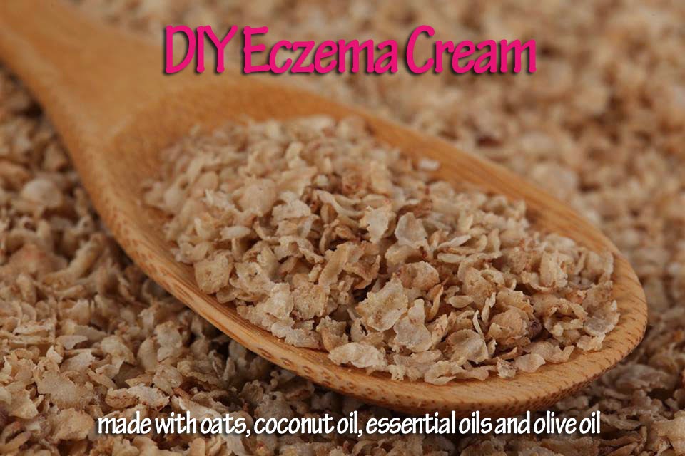 Purify Your Body Detox Foot Pads DIY Eczema Cream Natural Relief for