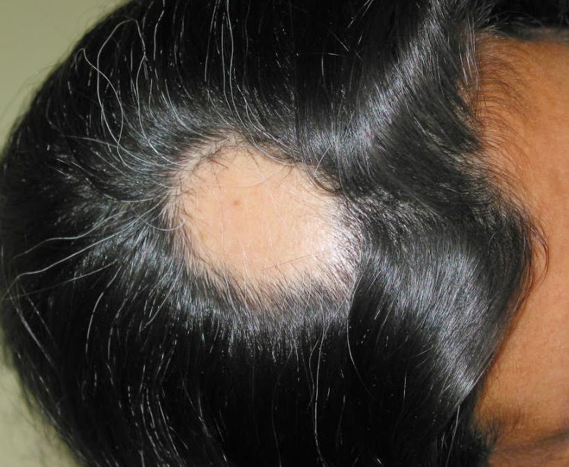 Los medios para el crecimiento de los cabello que champú