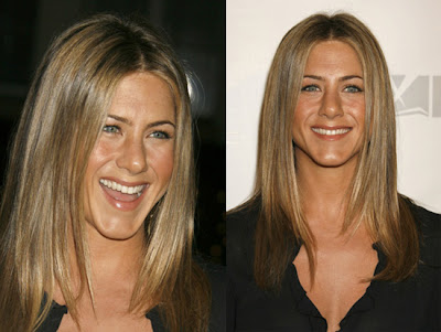 Jennifer Aniston Plastic Surgery on Picture Gallery  Jennifer Aniston Plastic Surgery Before And After