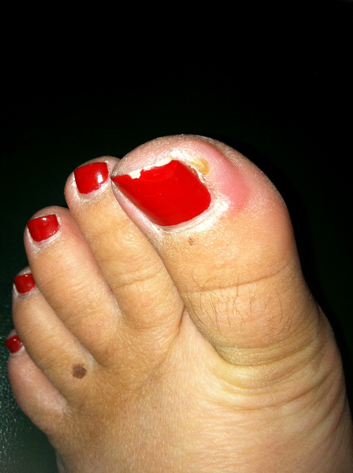 Daily Diabetic Check your feet