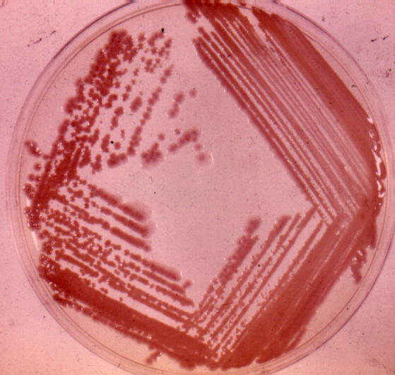 Auger Gear Image Agar Plate