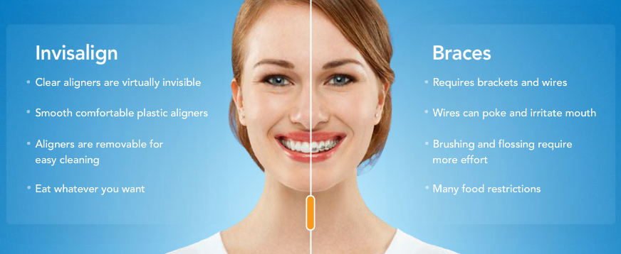 Best Orthodontist In Kitchener Waterloo Best Orthodontist In Kitchener Waterloo