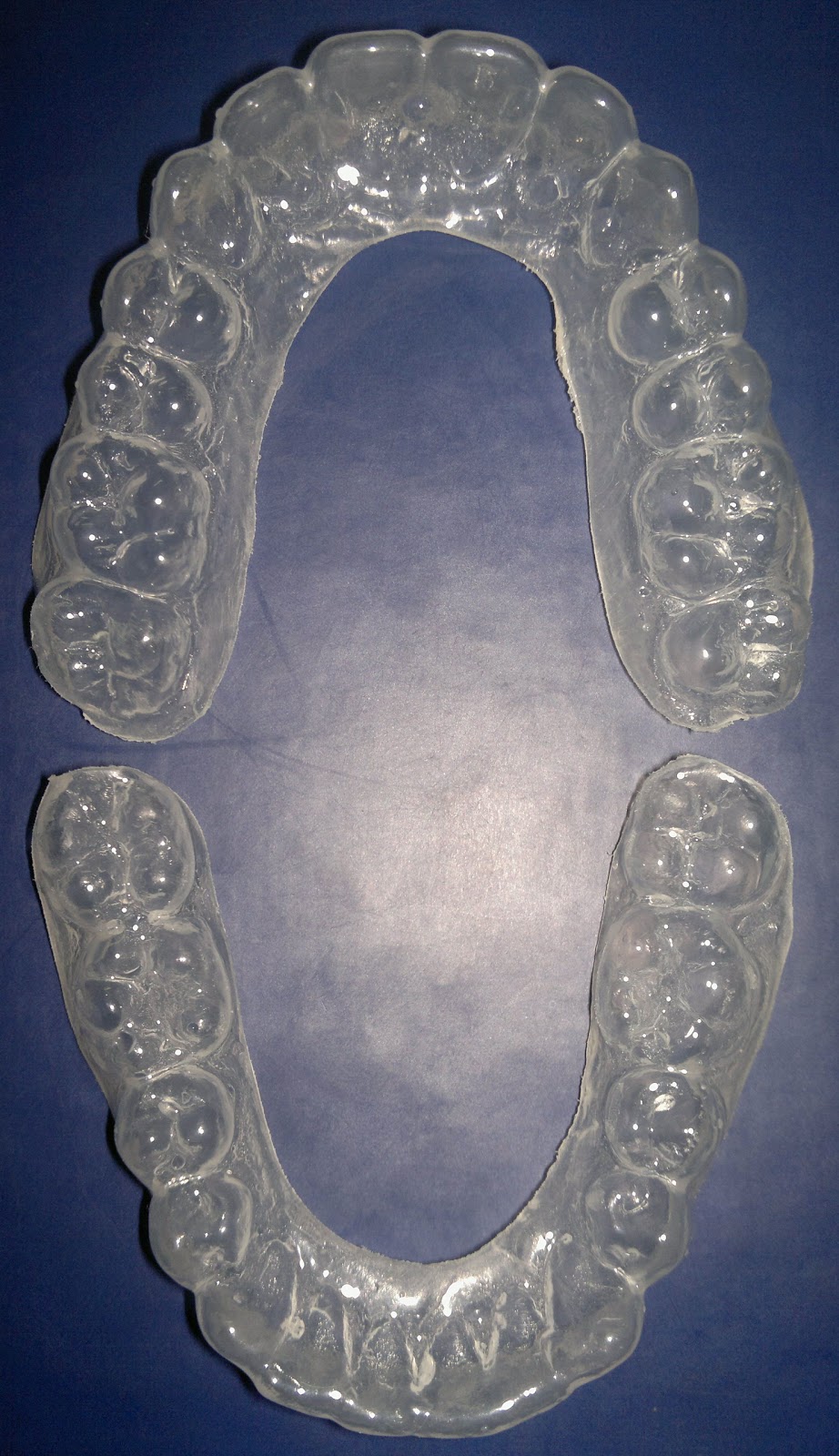 Spot lights(zzz) on me! Embrace the bracesnomore!