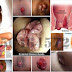 Ambeclear Obat Wasir POM TR: 133 374 041 thumbnail