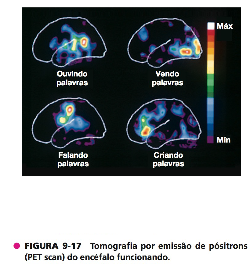 Tomografia por emissão de pósitrons (PET scan) do encéfalo funcionando