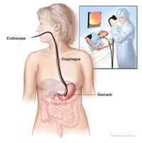 Diagnostic par le gastro-entérologue: la gastroscopie duodénale