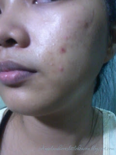 Shiseido White Lucent Skin Challenge Day3 Shiseido White Lucent Skin Challenge Day3