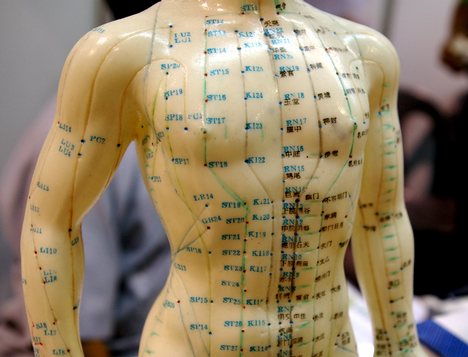 Where can I find a diagram of body pressure points?