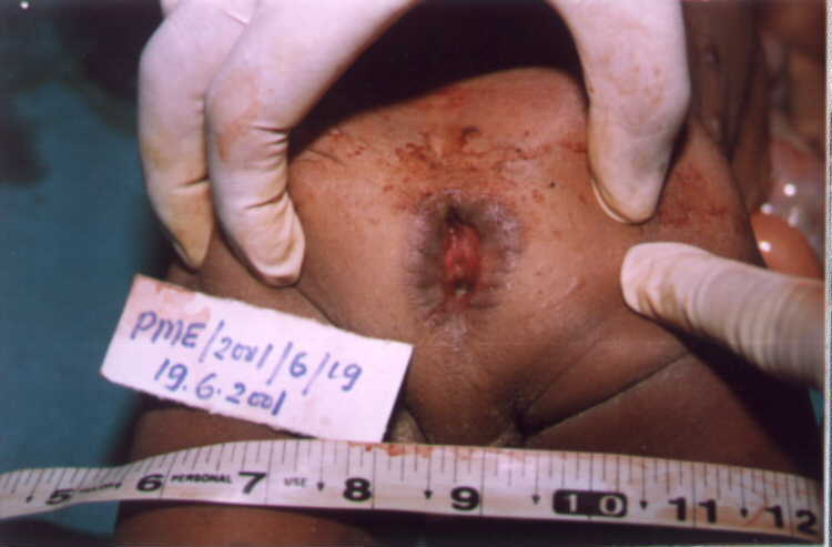 anal sex hvordan anatomi kvinde anal sex hvordan anatomi kvinde