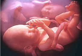 Η Έκτρωση είναι Φονική Ενέργεια που γίνεται με την συγκατάθεση της μητέρας.