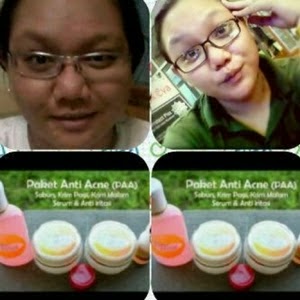 racikan pemutih kulit badan harga pemutih wajah wallet