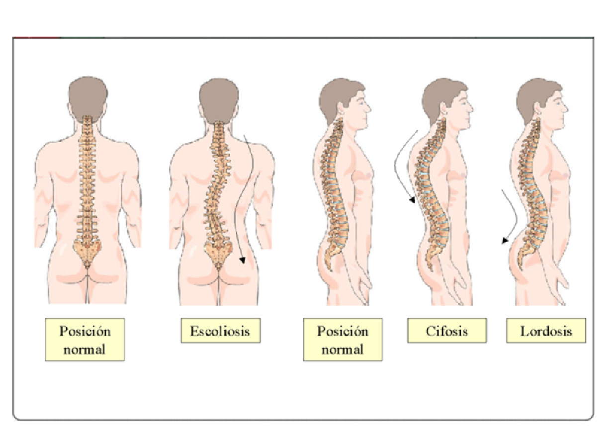 La curvatura de la columna vertebral al bebé de un año
