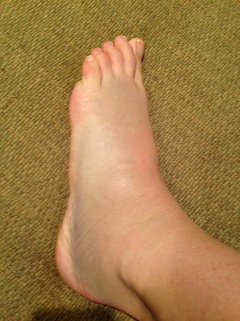 Life Through Endurance...: Exercises for Weak Ankles and a Reminder
