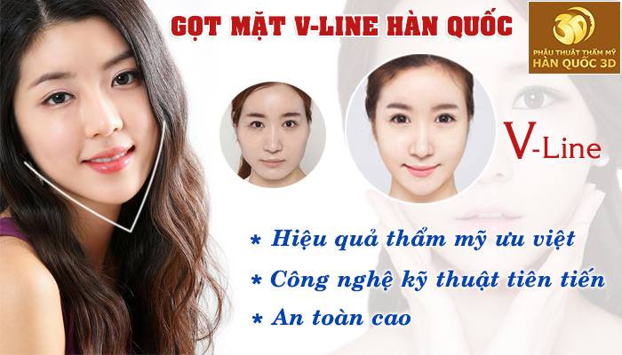 Gọt mặt v line Hàn Quốc