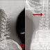 World's Most Shocking X-rays (Page 1 of 2)