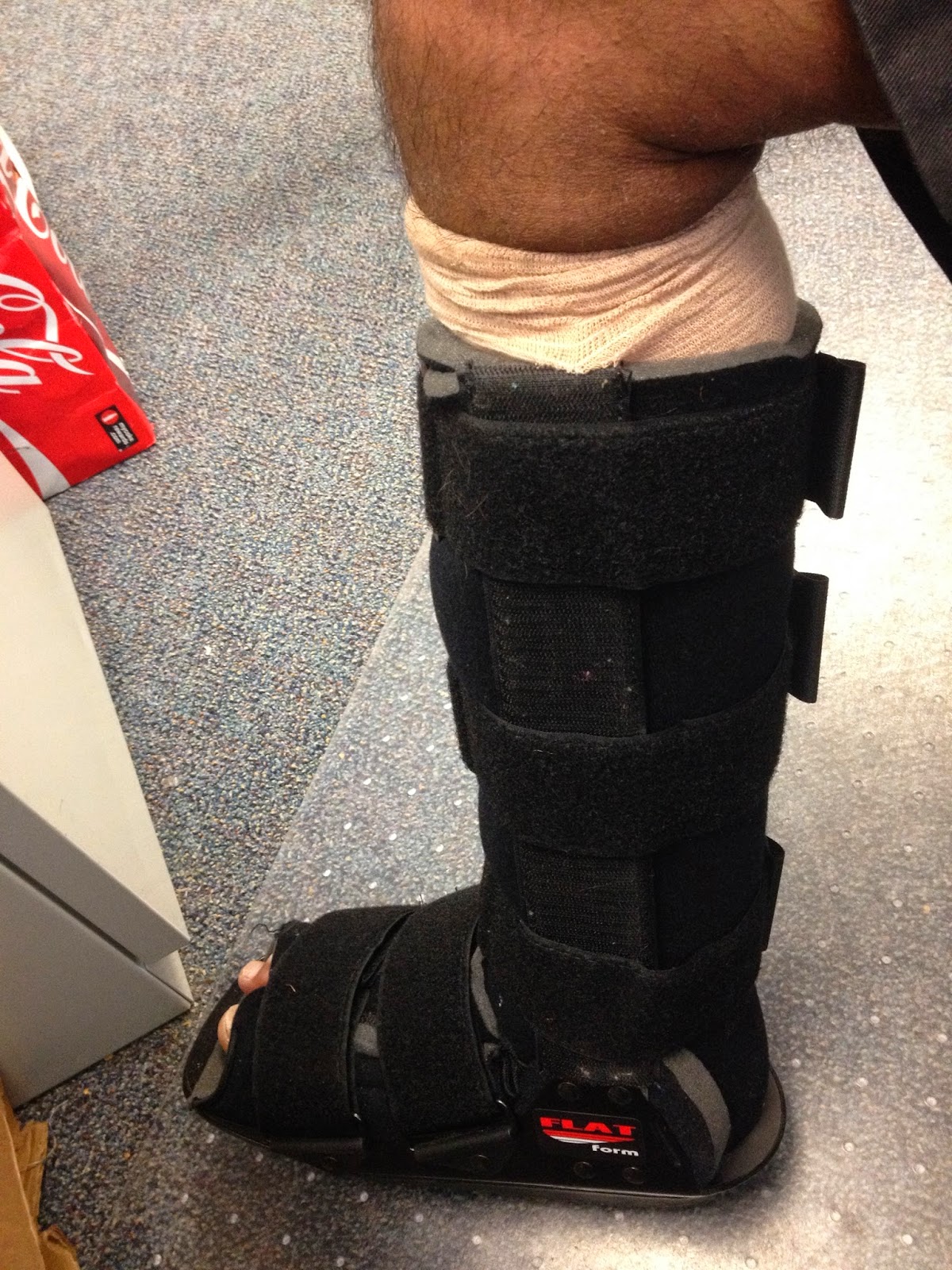 My Ankle Out of the Cast into a Walking Boot I Can't Walk in