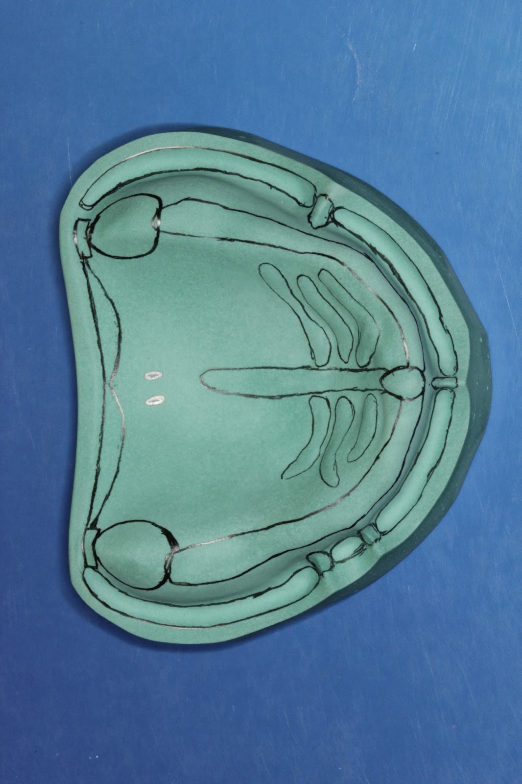 Step by step Guide for Understanding the Prosthodontics Anatomical