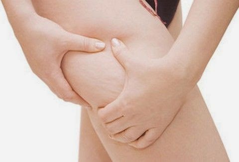 Ξέρετε ποιος είναι ο "ΕΧΘΡΟΣ" της κυτταρίτιδας;;; Εμείς ΝΑΙ! Δείτε και πείτε "αντίο" στην όψη φλοιού πορτοκαλιού! Ξέρετε ποιος είναι ο "ΕΧΘΡΟΣ" της κυτταρίτιδας;;; Εμείς ΝΑΙ! Δείτε και πείτε "αντίο" στην όψη φλοιού πορτοκαλιού!