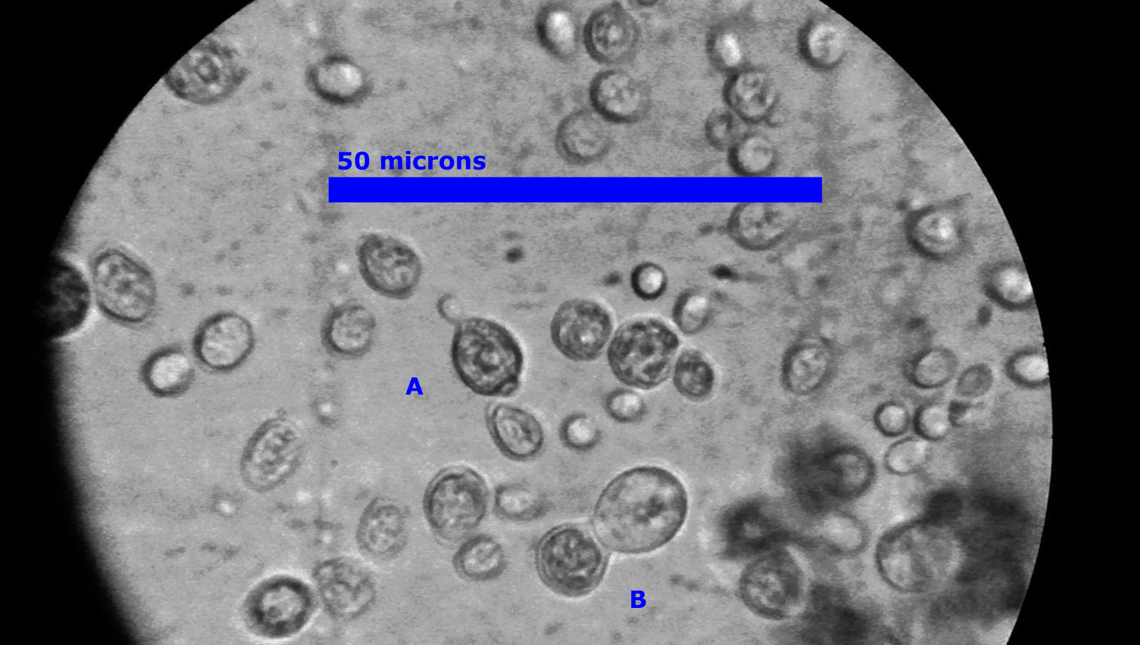 Woodland Brewing Research Sporulation in Brewers Yeast