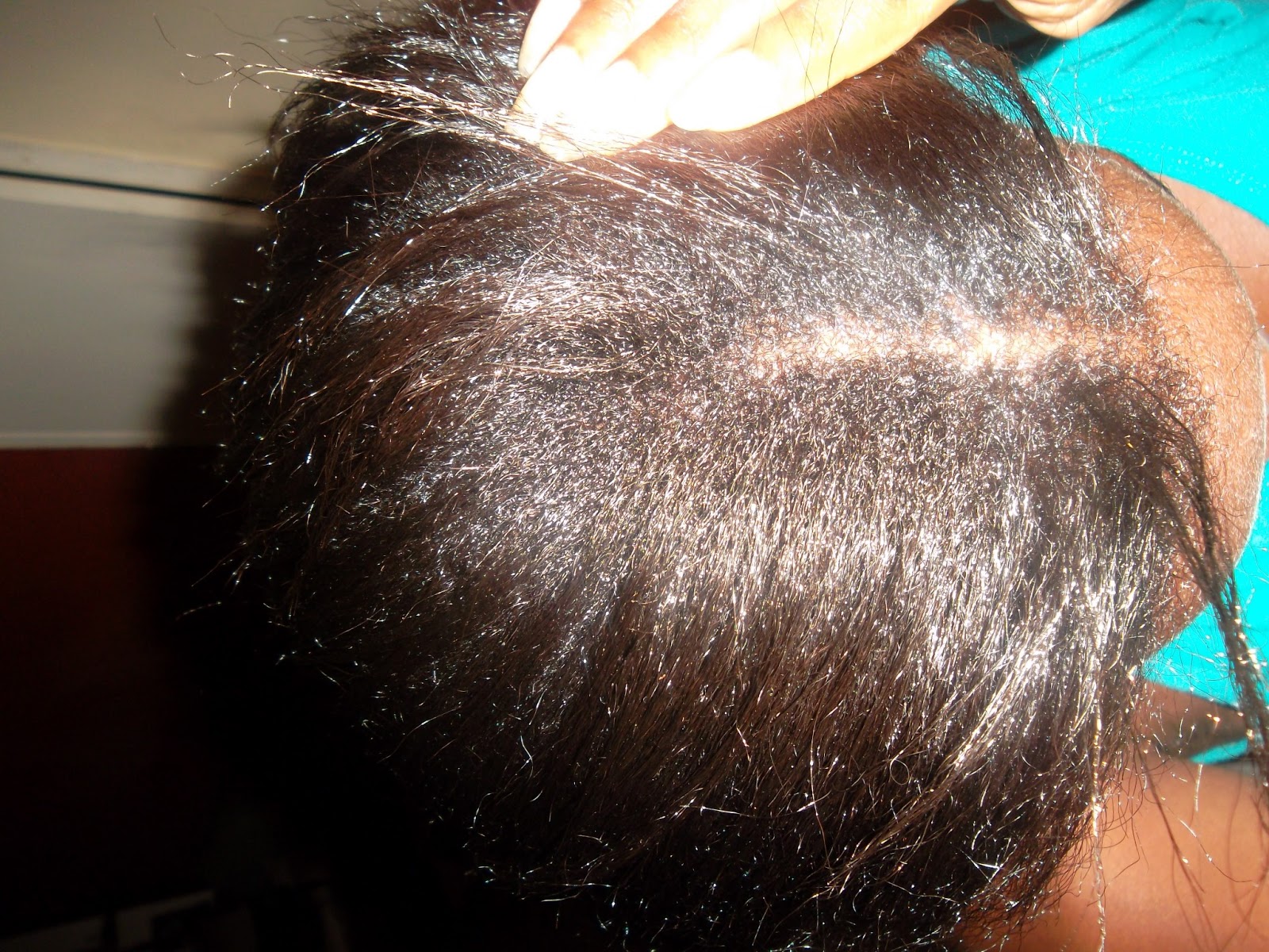 The Hair Journey 6 Weeks Post Relaxer And Banana Hair
